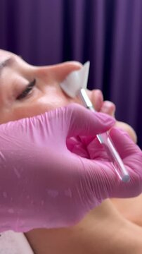 Chemical Peel Face Treatment with Retinol Serum.