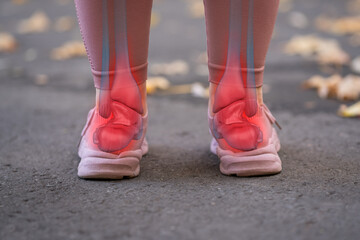 Achilles tendon injury, joint inflammation, foot pain, heel spur, woman suffering from feet ache...