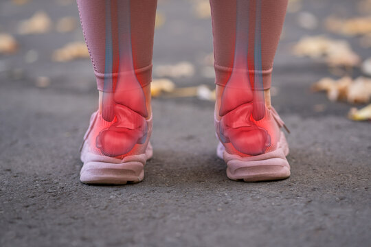 Achilles tendon injury, joint inflammation, foot pain, heel spur, woman suffering from feet ache while jogging, podiatry concept