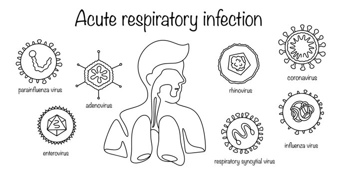 Acute respiratory infection