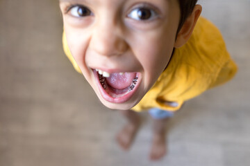 Dental care concept. Stainless steel crown a silver cap used for restoring children's teeth