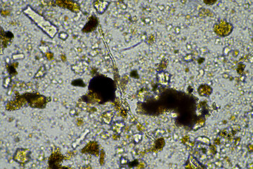 microorganisms and soil biology, with nematodes and fungi under the microscope. in a soil and...