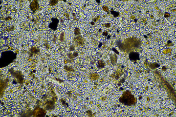 microorganisms and soil biology, with nematodes and fungi under the microscope. in a soil and...