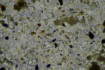 microorganisms and soil biology, with nematodes and fungi under the microscope. in a soil and compost sample