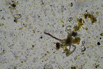 microorganisms and soil biology, with nematodes and fungi under the microscope. in a soil and...
