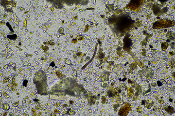 microorganisms and soil biology, with nematodes and fungi under the microscope. in a soil and compost sample