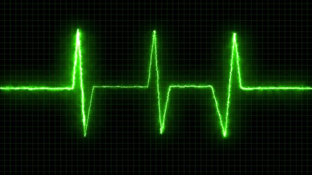 Glowing neon heartbeat pulse animation icon on a black background.