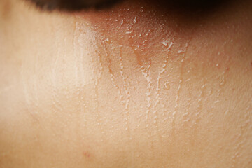 Fototapeta premium closeup of sweat on body 