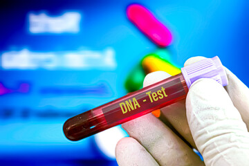Biological specimen (blood) in vacuum tube for pathological analysis. Medical laboratory various...