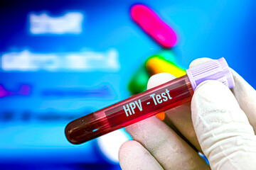 Biological specimen (blood) in vacuum tube for pathological analysis. Medical laboratory various testing concept. health care conceptional images