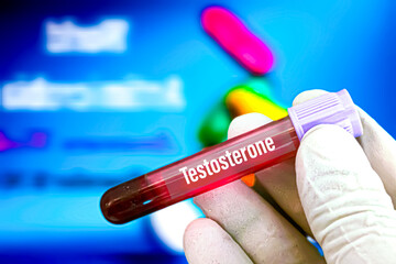 Biological specimen (blood) in vacuum tube for pathological analysis. Medical laboratory various testing concept. health care conceptional images