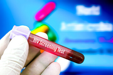 Biological specimen (blood) in vacuum tube for pathological analysis. Medical laboratory various...