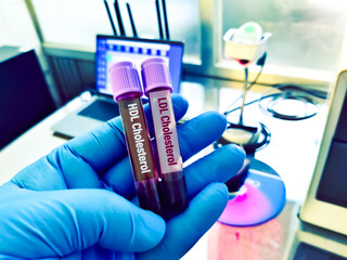 Blood samples for HDL Cholesterol (good cholesterol) and LDL Cholesterol (bad cholesterol)  and Tg...