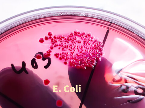 Medical technologist holds Bacteria culture growth on chromogenic media plate in Microbiology Laboratory, Escherichia coli (E. coli) bacteria culture growth on a petri dish
