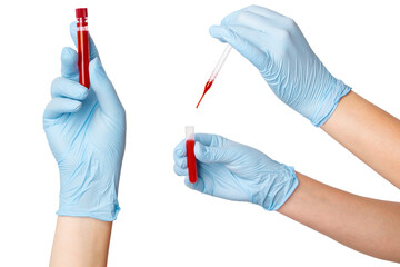 Set of hands in medical gloves holding a test tube and a pipette with blood on an empty background....