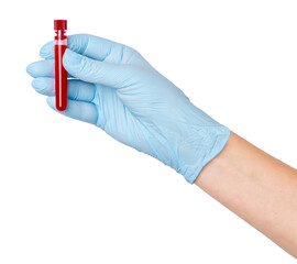 Hand in medical gloves holding a test tube with blood on an empty background. Medical testing, laboratory analysis, healthcare diagnostics.