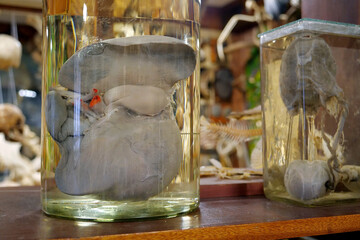 Human liver in glass flask. Major metabolic organ