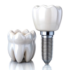 Isolated set of white teeth and dental implant on transparent background