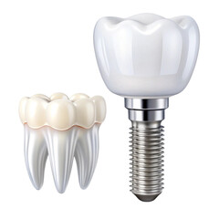 Isolated set of white teeth and dental implant on transparent background