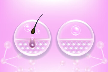 Hyaluronic acid before and after hair removal and skin solutions ad. pink collagen serum drop into skin cells with cosmetic advertising background ready to use, illustration vector.