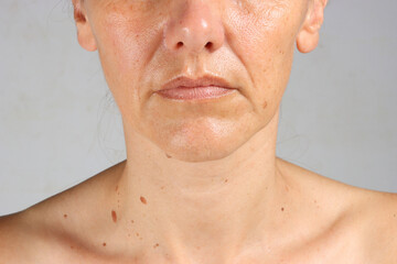 close-up on the wrinkles around the mouth of a 45-year-old woman , nasolabial folds