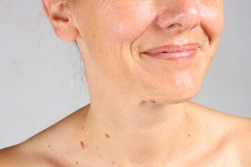 Obraz premium close-up on the wrinkles around the mouth of a 45-year-old woman , nasolabial folds