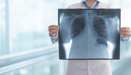 Doctor radiology looking chest or lung x-ray images at hospital ward to diagnose pneumonia or inflamed lungs. medical check up concept.