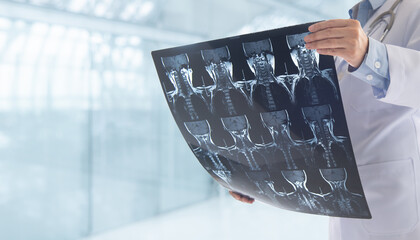 Doctor radiology or surgeon check cervical spine x-ray film by ct scan and mri scan of Cervical Spine Osteoarthritis patient.