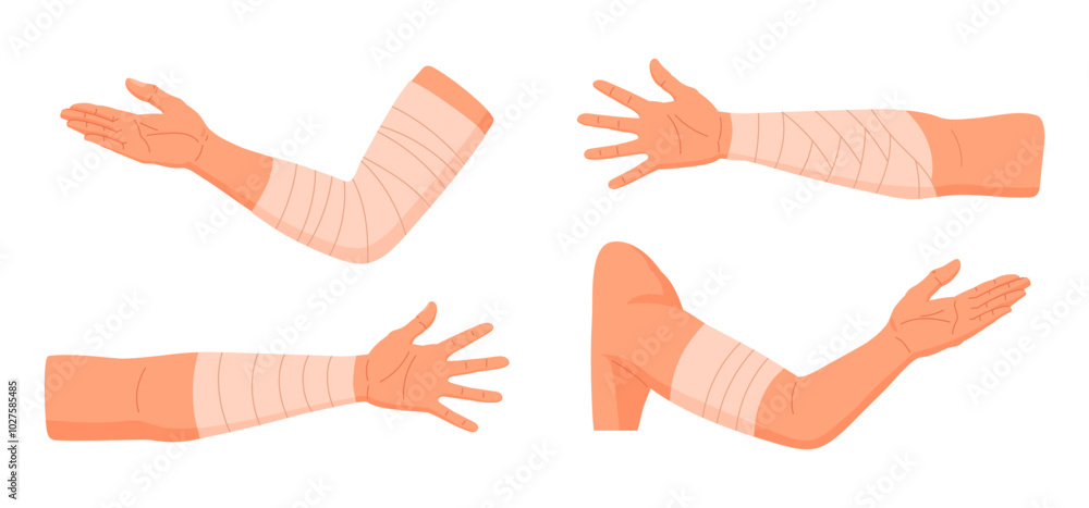 Wall mural injured human arms. bandaged elbows and forearms, damaged arm parts, emergency treatment for bones f