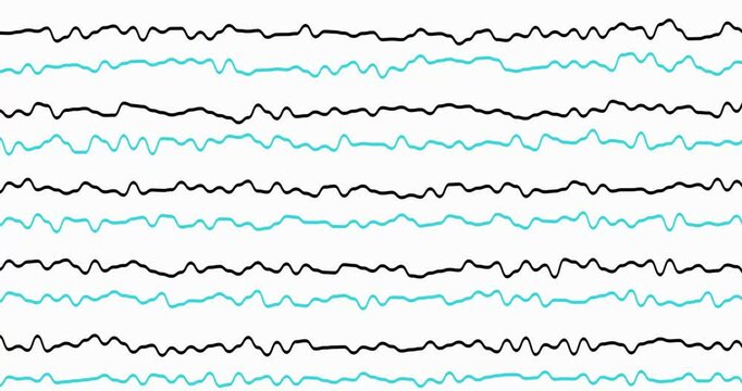 line motion graphic background wiggle effect