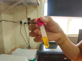 Pathologist Handling Laboratory Samples, Medical laboratory with vials and scientific equipment.