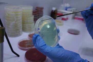 Laboratory technician wearing blue gloves handles a petri dish with bacterial cultures in a lab