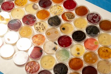 Petri dishes with various cultures in a laboratory