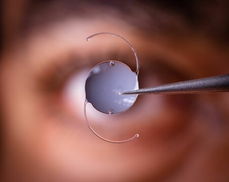Intraocular lens held by tweezers with a blurred eye in the background.
