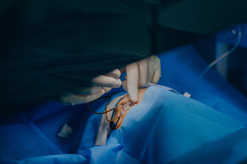 Eye surgery in a modern clinic. Vision correction	

