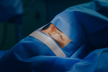 Eye surgery in a modern clinic. Vision correction	
