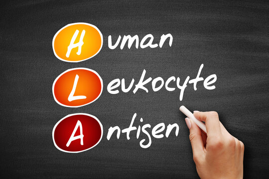 HLA - Human Leukocyte Antigen acronym, health concept on blackboard