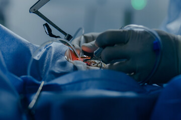 Eye surgery in a modern clinic. Vision correction	
