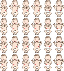 人工肛門、ストーマ、大腸、子供、こども、赤ちゃん、イラスト、illustration