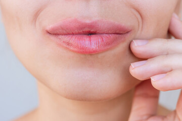 Close up of young caucasian woman's face with perfect lips after lip enhancement. The girl...