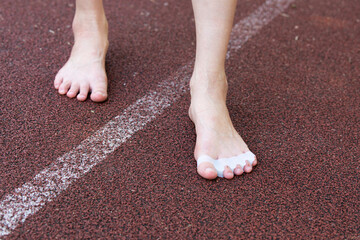 Close-up of female bare feet standing on a textured surface. The feet are wearing in silicone toe separators, promoting toe alignment and foot health. Self-care procedures for healthy feet.