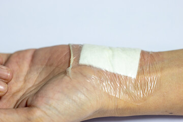 Wound and Scar on different parts of the body, Caused by an accident.	