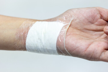 Fototapeta premium Wound and Scar on different parts of the body, Caused by an accident. 