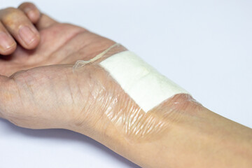 Wound and Scar on different parts of the body, Caused by an accident.	