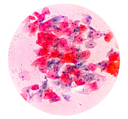 Buccal smear showing desquamated squamous cells of the oral mucosae. Small bluish points located...