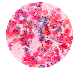Buccal smear showing desquamated squamous cells of the oral mucosae. Small bluish points located mainly on the right cell are bacteria. Light micrograph. HE stain.