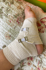 Bandages on patient's leg at home, leg injury.  Bone fracture, traumatology, physical injury.
