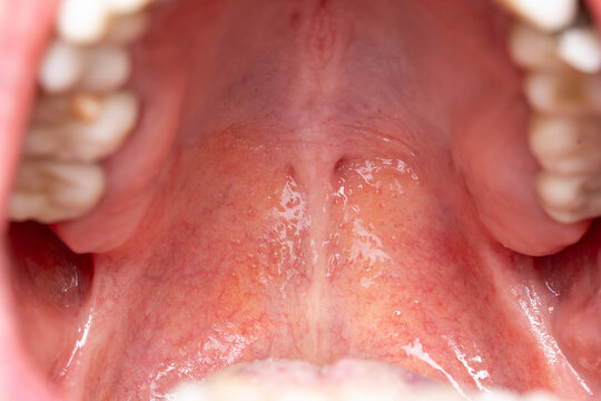 Caucasian man oral cavity, roof of the mouth and fovea palatine ducts. Close up, macro shot