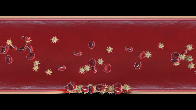 Red blood cells and platelets in wound healing demonstrating Hemostasis process