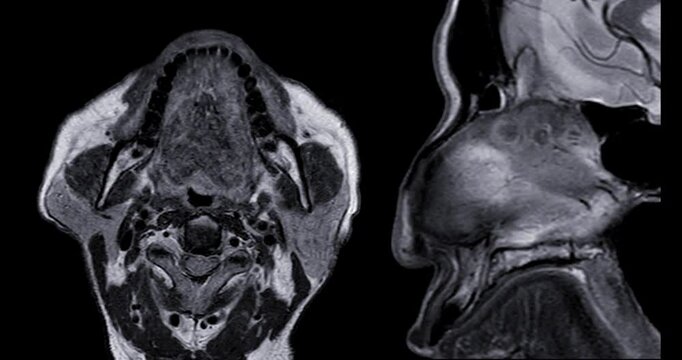 High-Resolution MRI Scan of Paranasal Sinuses for Medical Diagnosis and Anatomical Study.